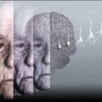 Alzheimer, ansia primo indicatore della malattia