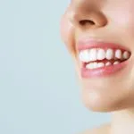 Apparecchio invisibile: una soluzione innovativa per denti più belli e sani